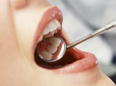 Лікування зубів